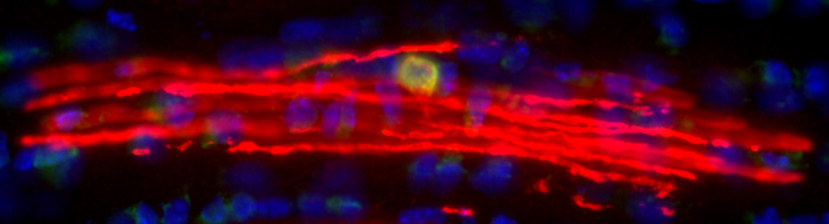 Myelinating oligodendrocyte in the developing mouse optic nerve (graphic)