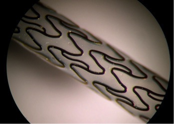 sheath stent