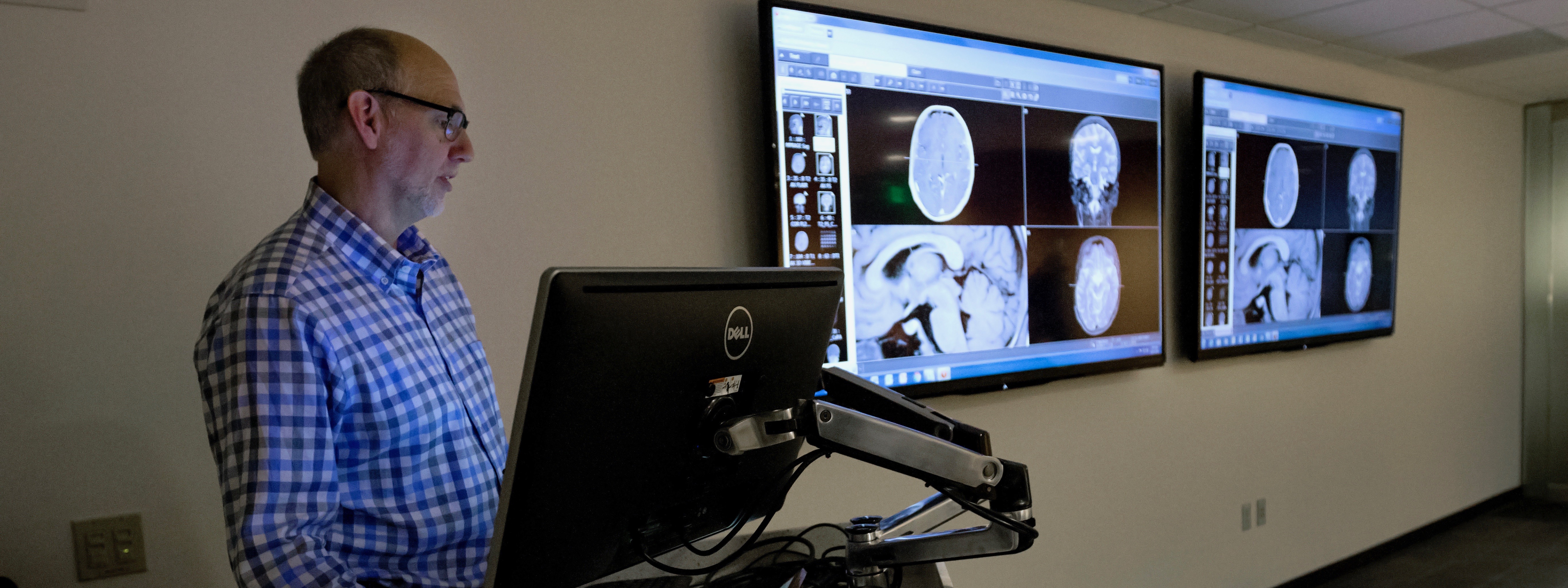 Dr. James Anderson, a neuroradiologist, shares an MRI scan and his expertise at a weekly Pediatric Brain Tumor Board