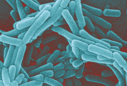 Microscopic image of lactobacillus
