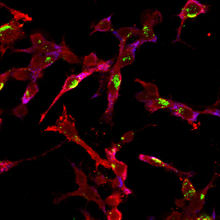 Image of BM140-1_2015715_MNV_min_plus_actin_6-PH-15_(c1+c2+c3).