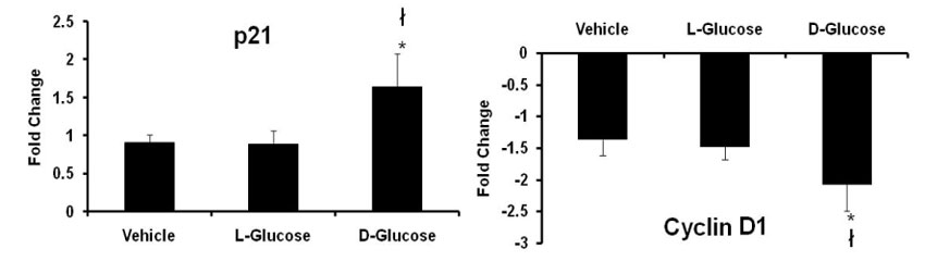 Two bar graphs, side by side. The left graph is labeled p21. Y axis is labeled fold change, measuring 0 to 2.5 in .5 increments. X axis compares three measurements: Vehicle, L-Glucose and D-Glucose. The right bar graph is labeled Cyclin D1. Y axis is labeled fold change, with increments of .5, from 0 to -3. X axis compares same three measurements: Vehicle, L-Glucose and D-Glucose.  