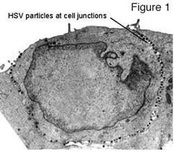 Figure one: HSV particles at cell junctions are marked with black dots on cell image.