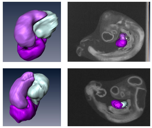Group of four images. The two on left show a heart in 3D. The two on right show a heart in context of chicken embryo. The two on top are from the control. The two on bottom are from hyperglycemic treatment.