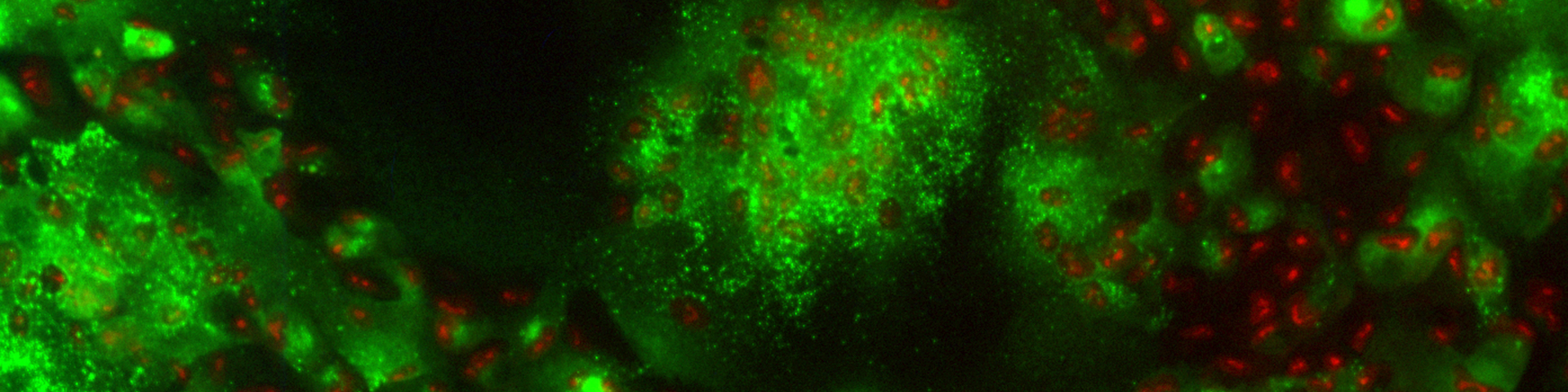 Image of ARPE-19 cells.