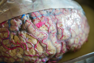 A picture of a brain.