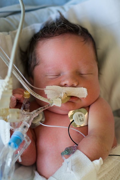 A photo of a newborn baby sleeping in the NICU at OHSU Doernbecher Children's Hospital.