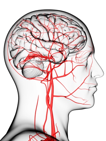 Understanding Stroke | Brain Institute | OHSU