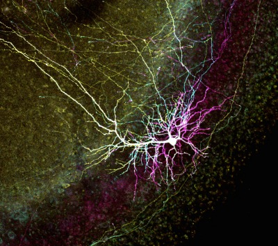 A colorful image of neurons.