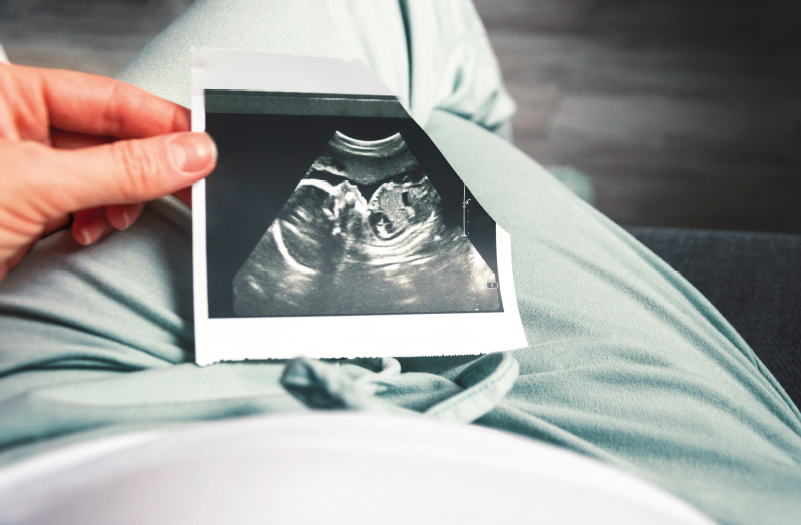 woman holds ultrasound image in lap.