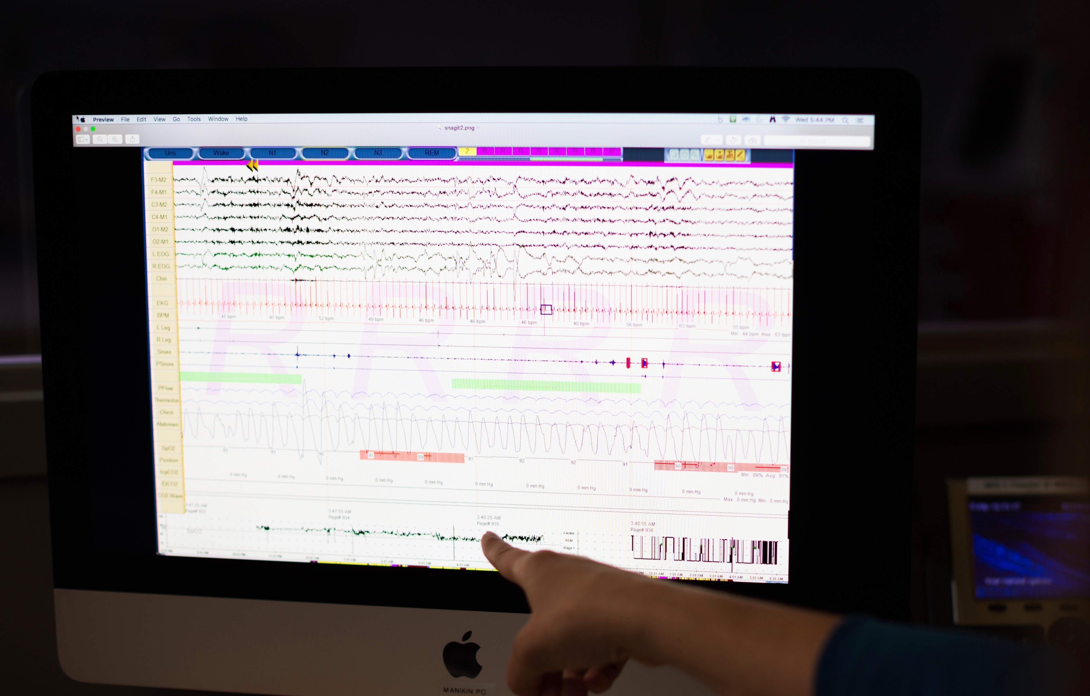 A polysomnogram displaying data to help make a precise diagnosis