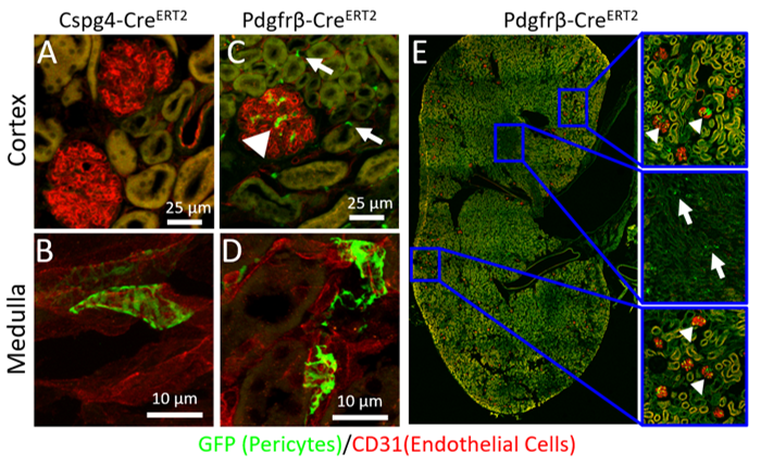 Figure 2 glomerulus histology GFP vs CD31