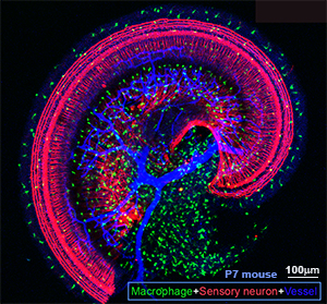 Macrophage, X. Shi, OHRC