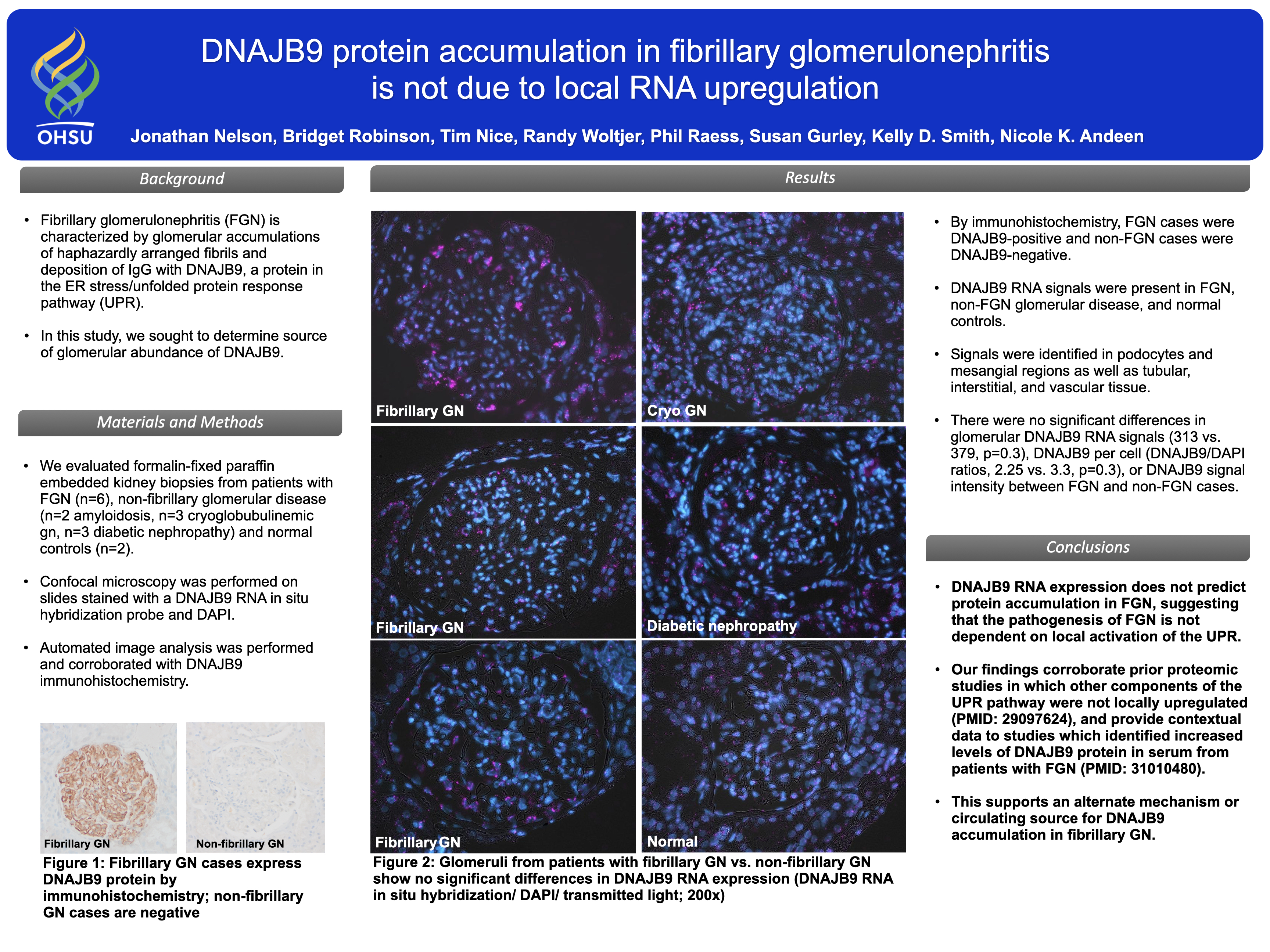 DNAJB9 protein poster