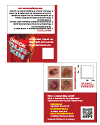 A thumbnail image of the melanoma self exam business card