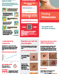 A thumbnail image of the melanoma self exam trifold brochure