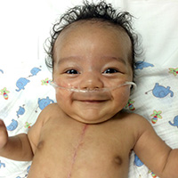 DCH Fetal Therapy patient Jacob Anderson V 