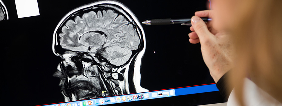 Photo of a provider pointing at a computer display of a brain scan