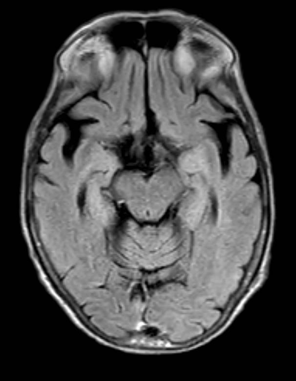 MRI Full Body MSK - Brain image for technologist reference