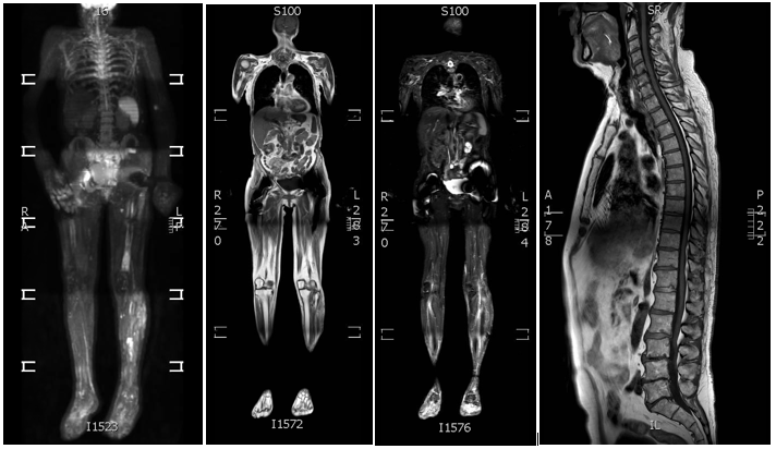 FULL BODY MSK IMAGES FOR POST PROCESSING INSTRUCTIONS FOR TECHNOLOGISTS