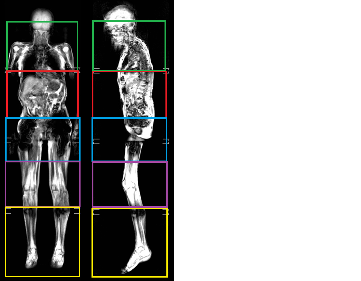 Full Body MRI station placement example for technologist reference