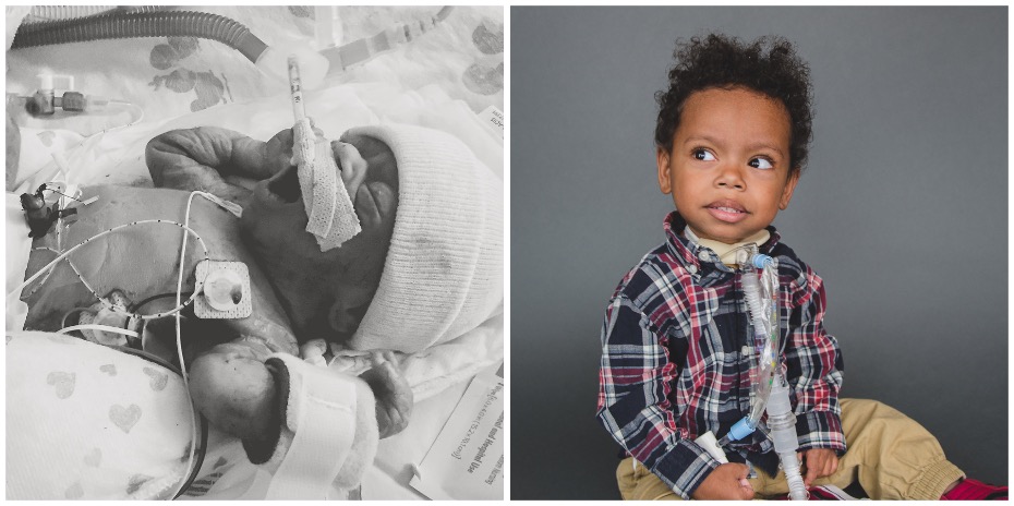 Two photos side-by-side, one black-and-white of a baby yawning while lying in the OHSU Doernbecher Children's Hospital NICU, and the other of a young boy sitting on the floor with a tube connected to his throat.