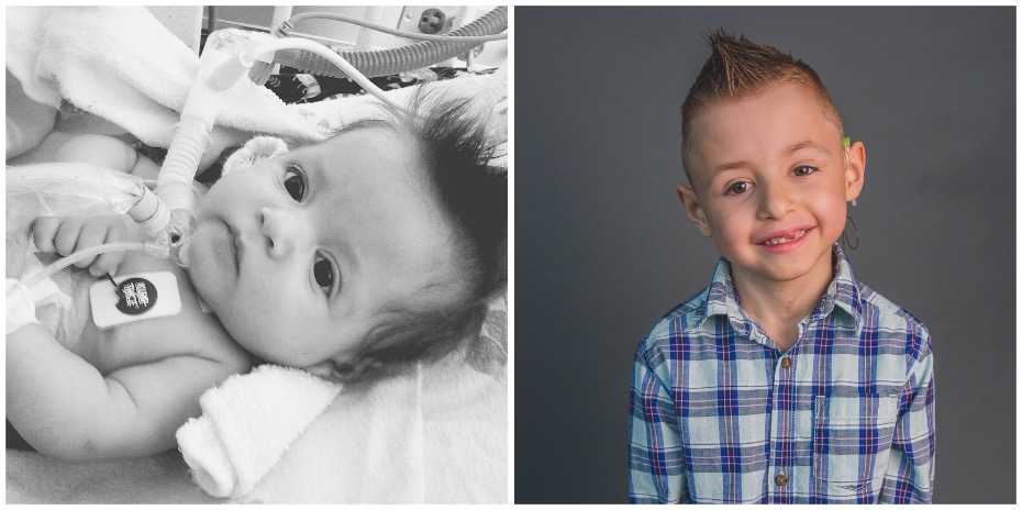 Two photos side-by-side, one black-and-white of a baby in the OHSU Doernbecher Children's Hospital NICU looking into the camera, and the other of a young boy with gelled hair smiling.