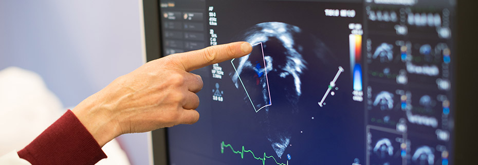 Photo of a hand pointing at a scan image on a monitor