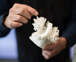 Photo of a 3D-printed heart model held in a person's hand