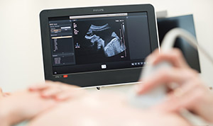 Photo of a pregnant person receiving a fetal scan