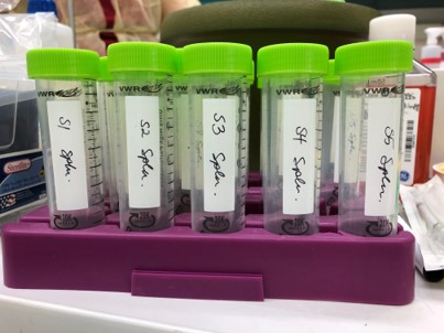Specimen samples are shown on a lab bench with labels reading S1, S2, S3, S4, and S5 Specimen. they all have green caps and are sitting on a purple holder tray
