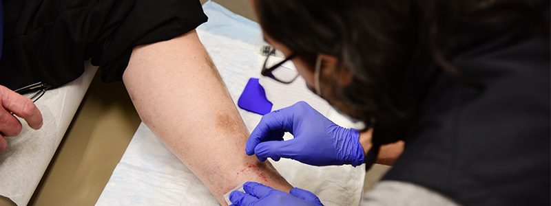 A man getting an ulcer cleaned in clinic by Dr. Alex Ortega