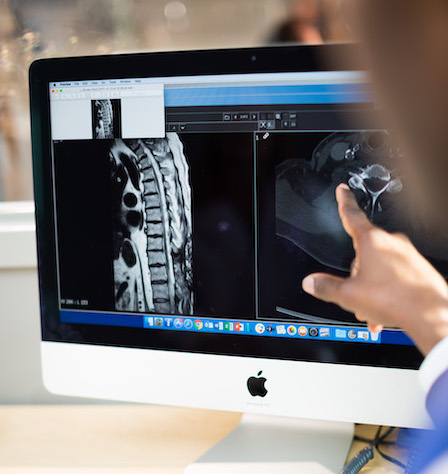 Photo of a person pointing at a monitor that shows a scan of a spine