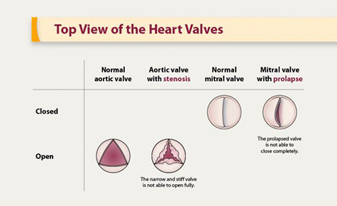 A diagram that shows a top view of the valves of the human heart.