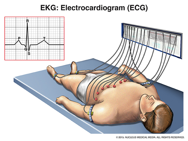 EKG Illustration | Heart Failure Diagnosis and Treatment | OHSU Knight Cardiovascular Institute