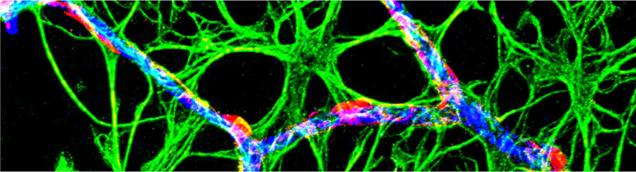 This image shows glial cells and blood vessels of the retina, which is the nervous tissue in the back of the eye. Tiny blood vessels called capillaries are shown in blue, vascular cells called pericytes are in red, and glial cells called astrocytes are in green. Astrocytes relay messages from active neurons to pericytes on capillaries to co-ordinate blood flow.