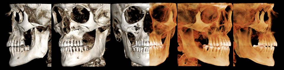 SOD Oral Radiology