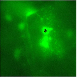 Image showing an astrocyte patched with dye allowed to diffuse through the syncytium coupled by gap junctions. Several nearby astrocyte cell bodies and their endfeet on a nearby capillary are visible.