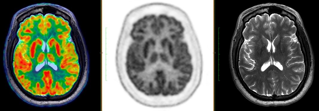 Diagnostic Radiology MRI and PET PACS Images with axial view of the brain v1