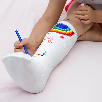A photo of a little girl on a bed coloring the cast that's on her right leg.