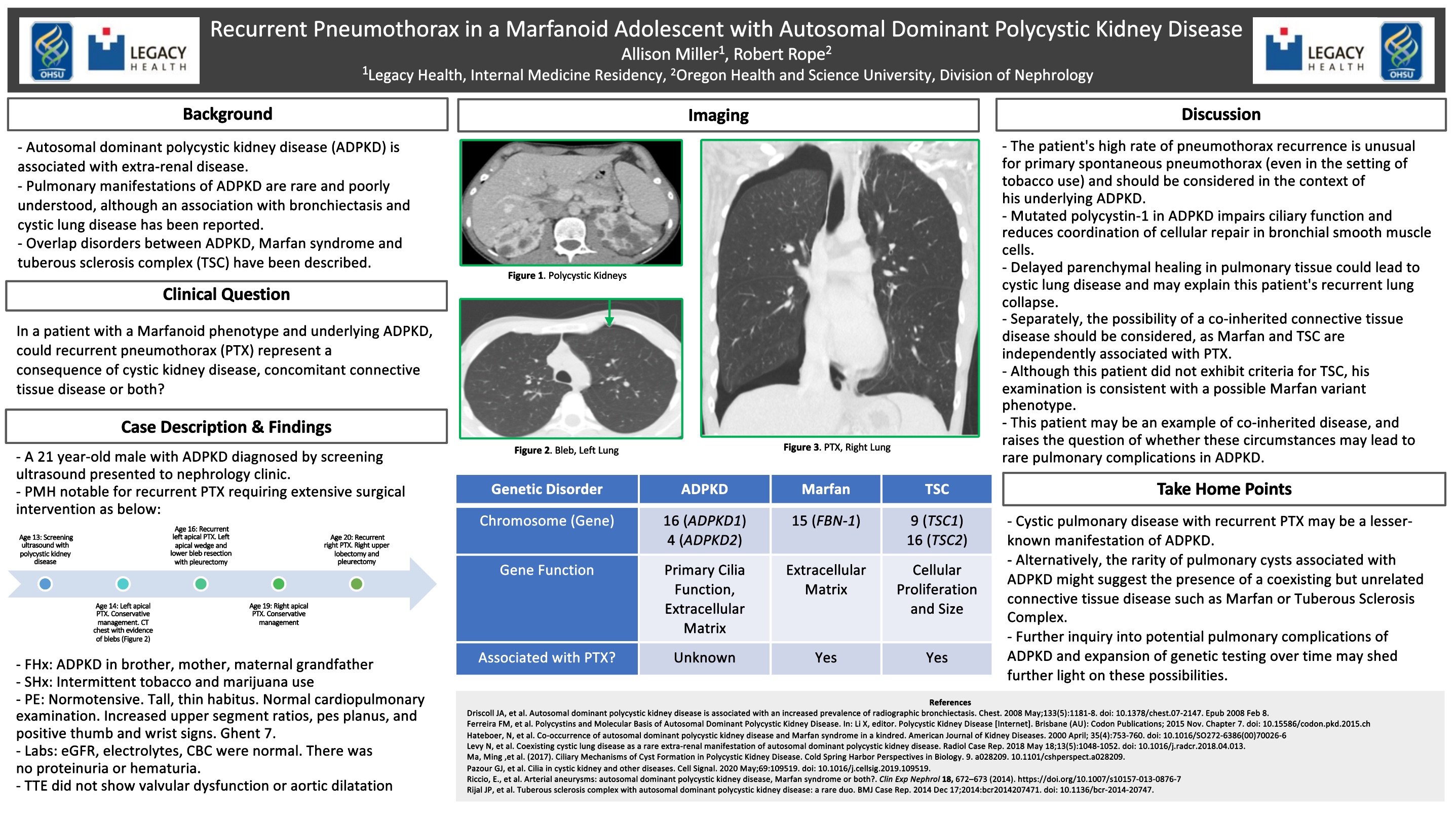 Recurrent Pneumothorax in a Marfanoid Adolescent with Autosomal Dominant Polycystic Kidney Disease