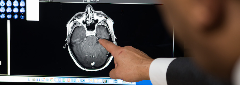 We use advanced imaging techniques, including high-resolution MRIs, to find and diagnose brain tumors