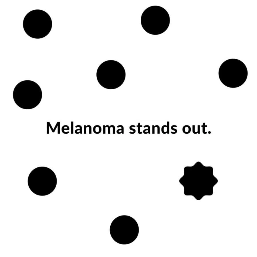 The words melanoma stands out is surrounded by circles and one misshapen shape.