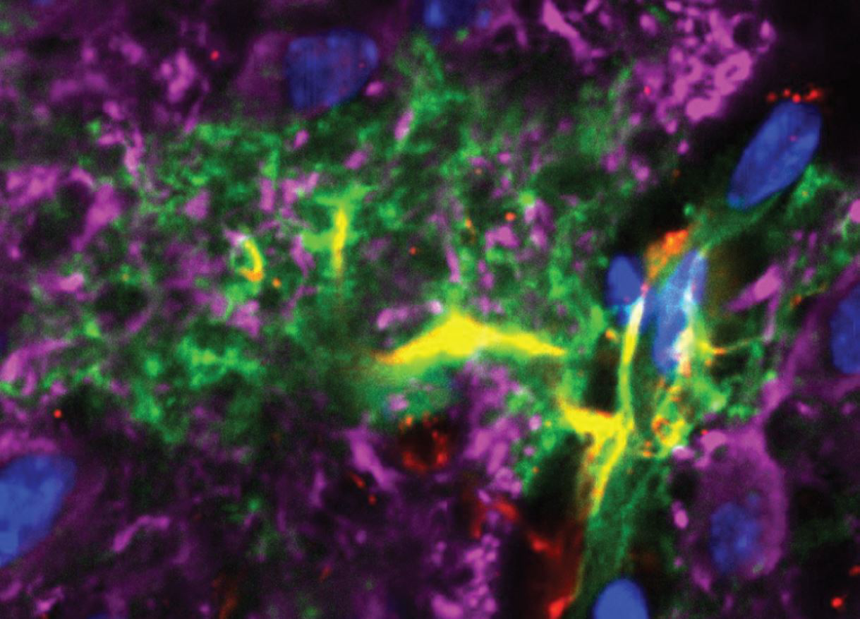 An astrocyte contacting a cortical capillary. The astrocyte is labelled with a genetically expressed green fluorescent protein (green) and immunolabeled for glial fibrillary acidic protein (red) with overlap shown in yellow; neurons are immunolabelled for microtubule associated protein (magenta); Nuclei are marked with DAPI (blue). The endfeet of the astrocyte demarcate the capillary.