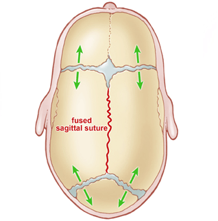 sagittal suture