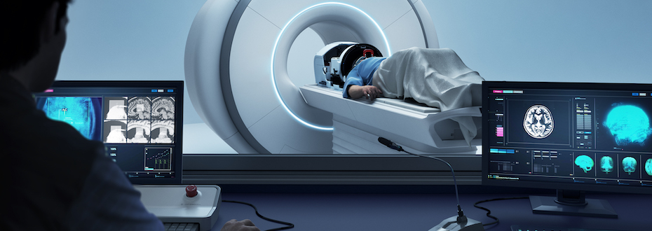 Image of a patient in an MRI suite with monitors showing scans