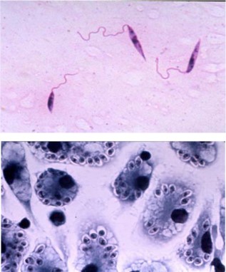 Leishmania parasites