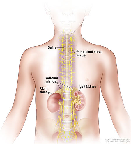 A medical illustration of the various neuroblastoma locations.