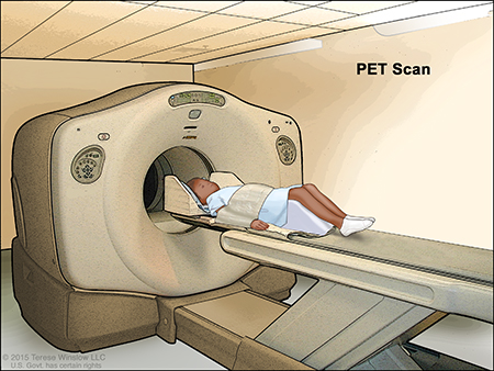An illustration of a boy lying down getting a PET Scan.