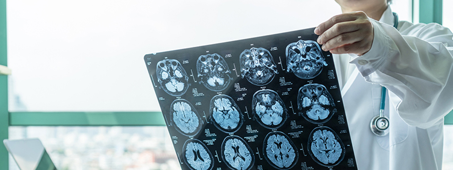 A male doctor holding up x-rays of a patient's brain scan.